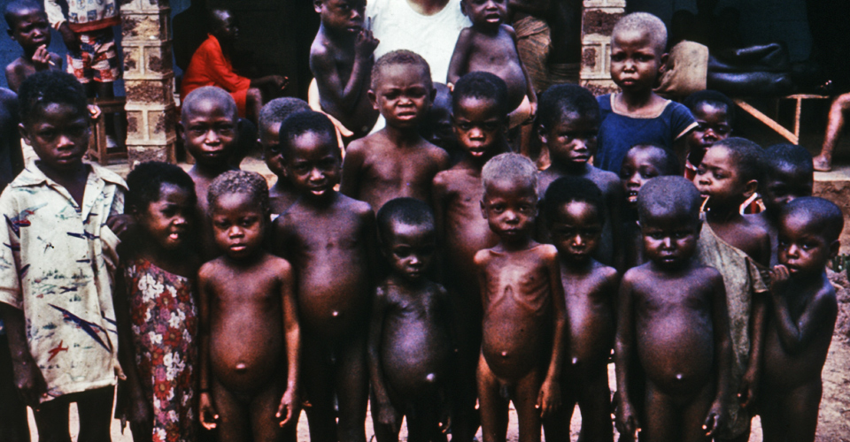 Children  at a Nigerian orphanage in the late 1960’s suffering from protein-deficiency disease, kwashiorkor